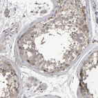 Immunohistochemical staining of human testis shows moderate cytoplasmic positivity in cells in seminiferous ducts.