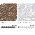 Anti-ALAD Antibody