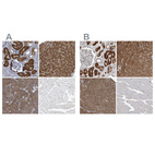 Anti-ALAD Antibody