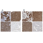 Immunohistochemical staining of human kidney, liver, pancreas and skeletal muscle using Anti-ALAD antibody HPA021023 (A) shows similar protein distribution across tissues to independent antibody HPA022124 (B).