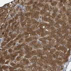 Immunohistochemical staining of human liver shows strong cytoplasmic positivity in hepatocytes.