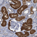 Immunohistochemical staining of human kidney shows strong cytoplasmic positivity in cells in tubules.