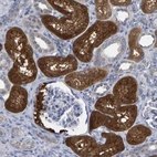 Immunohistochemical staining of human kidney shows strong cytoplasmic positivity in cells in tubules.