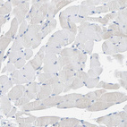 Anti-ALAD Antibody