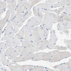Immunohistochemical staining of human skeletal muscle shows no cytoplasmic positivity in myocytes as expected.