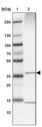 Lane 1: Marker [kDa] 250, 130, 100, 70, 55, 35, 25, 15, 10_br/_Lane 2: Human Liver tissue