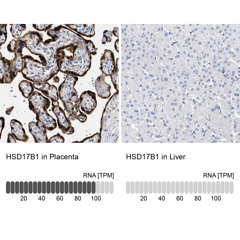 Anti-HSD17B1 Antibody