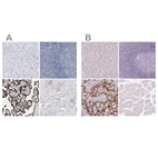 Immunohistochemical staining of human liver, lymphoid tissues, placenta and skeletal muscle using Anti-HSD17B1 antibody HPA021032 (A) shows similar protein distribution across tissues to independent antibody HPA065296 (B).