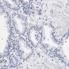 Anti-HSD17B1 Antibody