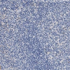 Immunohistochemical staining of human tonsil shows no cytoplasmic positivity in non-germinal center cells as expected.