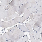 Immunohistochemical staining of human skeletal muscle shows no cytoplasmic positivity in myocytes as expected.