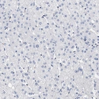 Immunohistochemical staining of human liver shows no cytoplasmic positivity in hepatocytes as expected.