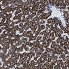 Immunohistochemical staining of human liver shows strong granular cytoplasmic positivity in hepatocytes.