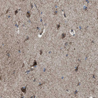 Immunohistochemical staining of human cerebral cortex shows strong granular cytoplasmic positivity in neurons.
