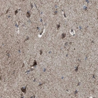 Immunohistochemical staining of human cerebral cortex shows strong granular cytoplasmic positivity in neurons.