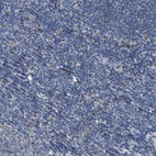 Immunohistochemical staining of human tonsil shows weak granular cytoplasmic positivity in non-germinal center cells.