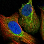 Anti-ALDH1B1 Antibody