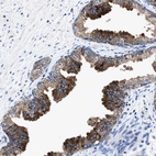 Anti-UBR4 Antibody