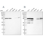 Western blot analysis using Anti-CCT8 antibody HPA021051 (A) shows similar pattern to independent antibody HPA018520 (B).
