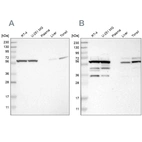 Western blot analysis using Anti-CCT8 antibody HPA021051 (A) shows similar pattern to independent antibody HPA018520 (B).