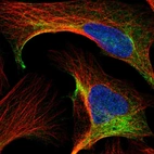 Immunofluorescent staining of human cell line U-2 OS shows localization to intermediate filaments.