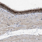 Anti-TPST2 Antibody