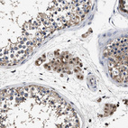 Immunohistochemical staining of human testis shows moderate granular positivity in cytoplasm in Leydig cells.