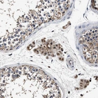 Immunohistochemical staining of human testis shows moderate granular positivity in cytoplasm in Leydig cells.