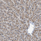 Immunohistochemical staining of human liver shows moderate granular positivity in cytoplasm in hepatocytes.