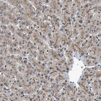 Immunohistochemical staining of human liver shows moderate granular positivity in cytoplasm in hepatocytes.