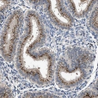 Immunohistochemical staining of human endometrium shows strong granular positivity in cytoplasm in glandular cells.