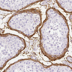 Anti-FBN1 Antibody