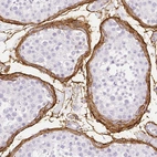 Immunohistochemical staining of human testis shows positivity in extracellular matrix.