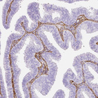 Immunohistochemical staining of human fallopian tube shows strong positivity in extracellular matrix.