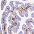 Anti-FBN1 Antibody