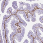 Immunohistochemical staining of human fallopian tube shows strong positivity in extracellular matrix.