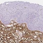 Immunohistochemical staining of human skin shows strong positivity in extracellular matrix.