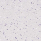 Immunohistochemical staining of human cerebral cortex shows no positivity as expected.