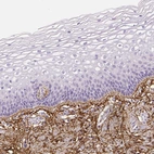 Immunohistochemical staining of human cervix, uterine shows moderate extracellular space positivity.