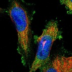 Immunofluorescent staining of human cell line U-251 MG shows localization to cytosol.