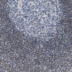 Immunohistochemical staining of human lymph node shows strong nucleolar and moderate nuclear positivity in non-germinal center cells.