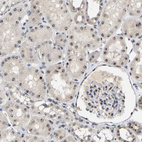 Immunohistochemical staining of human kidney shows strong nucleolar positivity in cells in tubules.