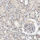 Immunohistochemical staining of human kidney shows strong nucleolar positivity in cells in tubules.