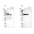 Western blot analysis using Anti-NOP58 antibody HPA021062 (A) shows similar pattern to independent antibody HPA018472 (B).