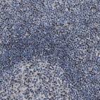 Anti-GTPBP10 Antibody