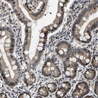 Immunohistochemical staining of human duodenum shows strong nuclear positivity in glandular cells.