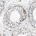 Immunohistochemical staining of human testis shows strong nuclear positivity in a subset of cells in seminiferous ducts.
