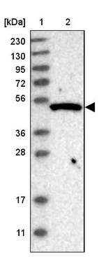 Lane 1: Marker [kDa] 230, 130, 95, 72, 56, 36, 28, 17, 11_br/_Lane 2: Human cell line RT-4