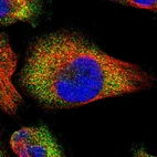 Immunofluorescent staining of human cell line U-251 MG shows localization to cytosol.