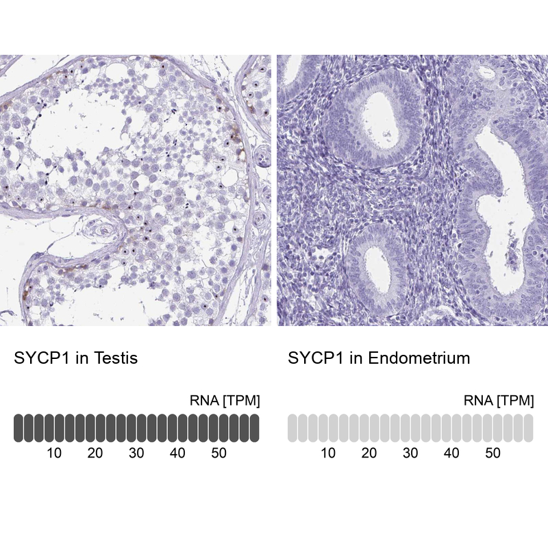 Anti-SYCP1 Antibody